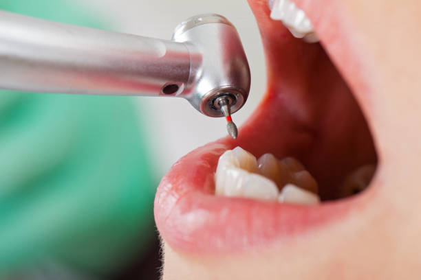 Emergency Dentist Open Today in MN
